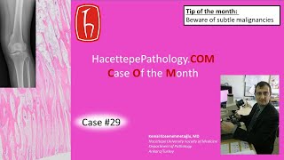 Case #29 - HacettepePathology . Case of the Month (COM)!