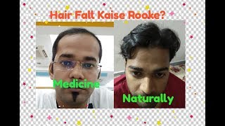 Hair Fall Stop By Naturally or By Medically - Decide What You Want