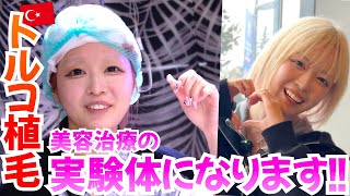 【女性 美容治療】デコハゲ おでこを狭くするためにトルコ植毛した 【ハウスダスト｜整形｜自毛植毛｜薄毛の窓口】