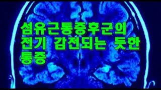 섬유근육통(fibromyalgia)과 전기감전된 듯한 통증