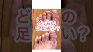 足をチェック！どっちの足指に近いですか？ #運動療法 #運動 #足指