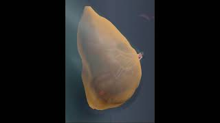 Breast anatomy 10 ( 3D Animation )