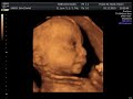 3d video vom baby 26 ssw