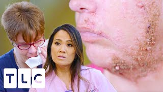 Patient Begs Dr. Lee For Numbing Cream Before Her Treatment I Dr. Pimple Popper