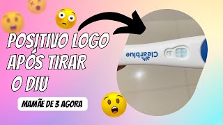 ENGRAVIDEI LOGO APÓS TIRAR O DIU/ COMO DESCOBRI QUE ESTAVA GRÁVIDA? TENTANTE APÓS TIRAR O DIU