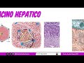 histología hÍgado lobulillo hepático sinusoides espacio perisinusoidal y Árbol biliar