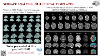 OHBM 2023 | Keynote | Emma Robinson | A roadmap towards precision cortical imaging