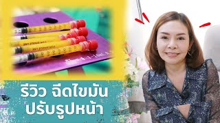 รีวิว ฉีดไขมันเติมเต็มปรับรูปหน้า Fat Grafting