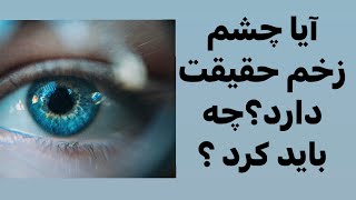 چشم زخم چیست آیا واقعیت دارد؟#آموزش #psychology #چشم_زخم