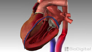 3D Medical Animation - Congestive Heart Failure