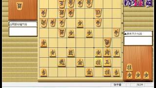 将棋 棋譜並べ ▲鈴木大介九段 vs △阿部光瑠六段 第65期王座戦挑戦者決定トーナメント 第4回将棋電王トーナメント準優勝「浮かむ瀬」の棋譜解析 No.1103