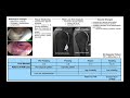 adhesive capsulitis frozen shoulder part 1 presentation u0026 pathophysiology