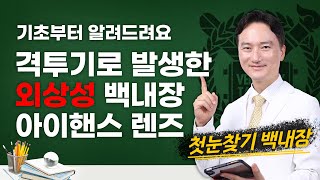 격투기로 인해 뿌옇게 보이는 외상성 백내장, 아이핸스 렌즈로 편하게 잘 보여요