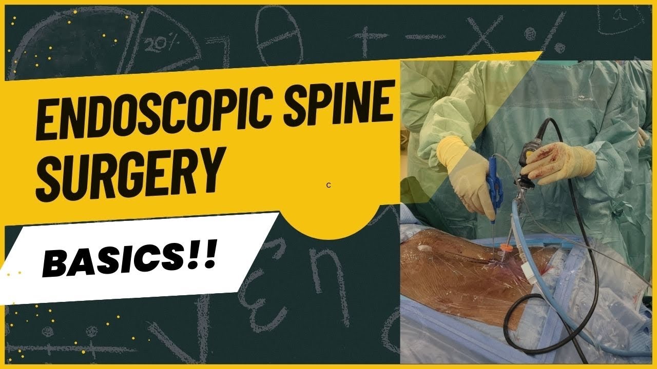 Endoscopic Spine Surgery Basics Youtube