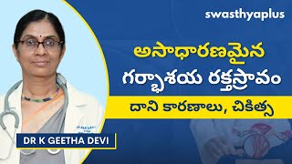 అసాధారణ యుటిరిన్ రక్తస్రావం: చికిత్స | Abnormal Uterine Bleeding (AUB) in Telugu | Dr K Geetha Devi