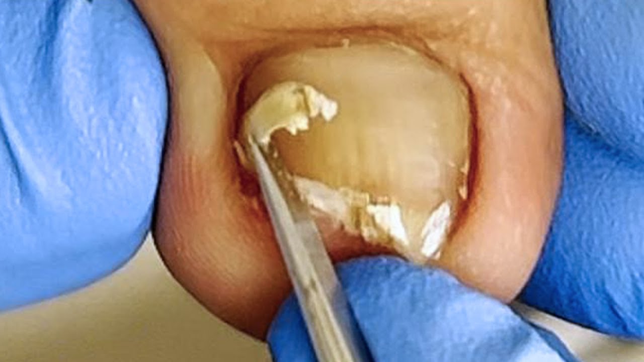 Obviously embedded armor, a bit petrified【Xue Yidao】