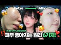 유튜버가 좋다는거 발라도 소용없는 이유🔥피부 좋아지는 원리 6가지 공개💪🏻스킨케어 꿀템 추천까지!!🔥ㅣ톡신TOXIN