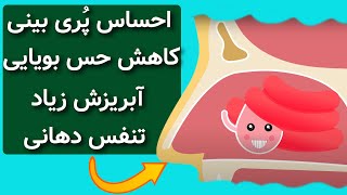 پولیپ بینی چیست؟ راه های درمان آسان ارزان و خانگی آن چیست؟جراحی کنم؟؟