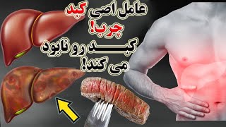 تحقیقات جدید محققان !عامل اصلی کبد چرب!