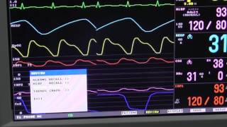 Demonstration of Spectra Slim patient monitor