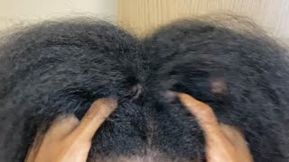 SAMZ ASMR/ SUPER CRISPY FAST \u0026 AGGRESSIVE SCALP SCRATCHING WITH (ABSOLUTELY NO BACKGROUND NOISE!!)