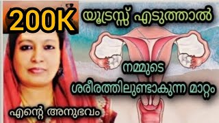 ഗർഭപാത്രം എടുത്ത് കളഞ്ഞാൽ നമ്മളിലുണ്ടാകുന്ന മാറ്റങ്ങൾ |  Uterus Removal Experience Story