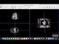 dicom viewer for apple using horos