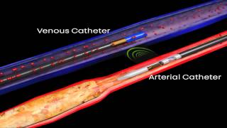 The LimFlow Procedure Explained