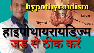 HYPOTHYROIDISM ,हाइपोथायरायडिज्म , लक्षण ,थायरोईड को जड़ से ठीक करें, thyroid