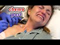 شاهد كيف يتم تركيب جاهز الكيمو بورت للمرضي _ What is the chemo port device?