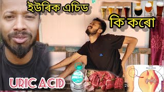 আপোনি ইউৰিক এচিড কেনেকে কমাব?🤔 How to Released Uric acid ?