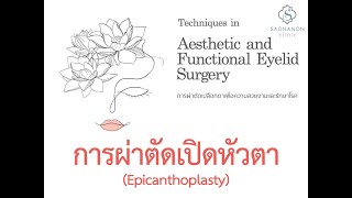 การผ่าตัดเปิดหัวตา Free trial จากหนังสือการผ่าตัดเปลือกตาเพื่อความสวยงามและรักษาโรค