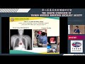 601趙梓淵 13 55 14 25 how i do it by technology with cases esophageal brachytherapy