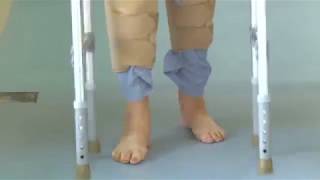 Arthritis \u0026 Knee Replacement (TKR) by Shalby Hospitals