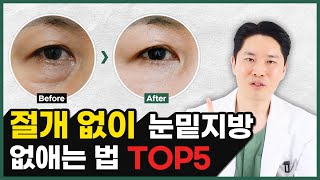 절개 수술 없이 눈밑지방 없애는 방법 TOP 5