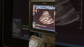 Shea’s OB 1st Tri demo - scan lab - 2/23/23