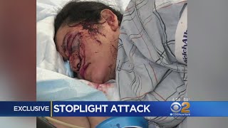 EXCLUSIVE: Red Light Beating Victim Speaks To CBS2