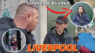 LIVERPOOL- STABBED in the EYE and now totally BLIND!!