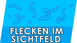 Flecken im Auge? Was hilft gegen Mouches volantes? fliegende Mücken \u0026 Glaskörpertrübung