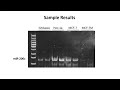 designing microrna specific cdna and pcr primers part 2 3 cell block