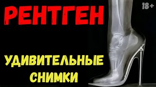 Рентген. Посмотри что просветили! Удивительно и невероятно!