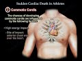 Sudden cardiac Death In Athletes - Everything You Need To Know - Dr. Nabil Ebraheim