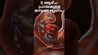 human embryo at the end of 5 weeks|5ആഴ്ച പ്രായമുള്ള മനുഷ്യ ഭ്രൂണം #shorts