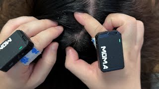 ASMR Tweezers \u0026 Short Nail Scalp Check: Insanely Satisfying Dandruff Removal