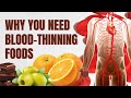 Heart Health: Natural Blood Thinners That May Prevent Stroke