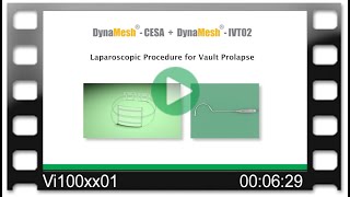 DynaMesh®-CESA-\u0026-IVT02 Laparoscopy OR-Video: Cervicosacropexy - Dr. Weingärtler