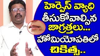 Herpes Symptoms and Causes  | హెర్పిస్ వ్యాధి తీసుకోవాల్సిన జాగ్రత్తలు.. హోమియోపతి లో చికిత్స