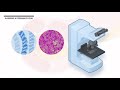 eus endoscopic ultrasound fnb u0026 intervention animation u0026 explanation