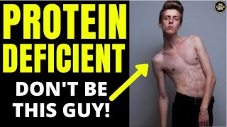Are YOU At RISK of Protein Deficiency?  YES, YOU ARE!  Here's How To Avoid It