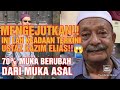 MENGEJUTKAN!!😱 INILAH KEADAAN TERKINI USTAZ KAZIM ELIAS!😢 70% MUKA BERUBAH DARIPADA MUKA ASAL!